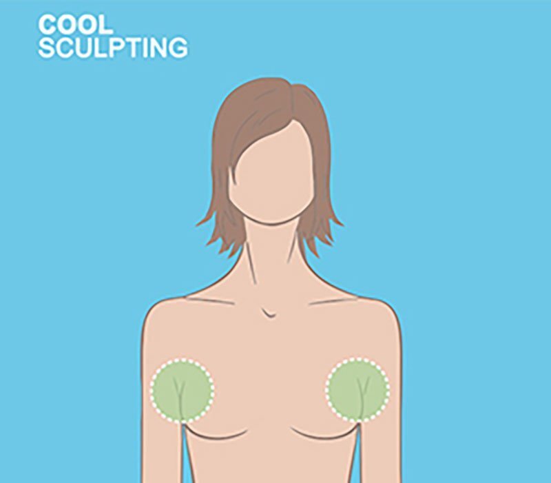 Upper Breasts - CoolMini Grand Rapids diagram