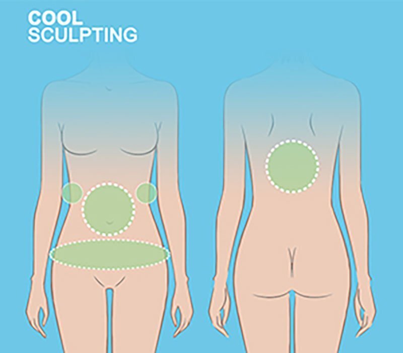 Abdomen, Flanks, Hips, Back - CoolMini Grand Rapids diagram