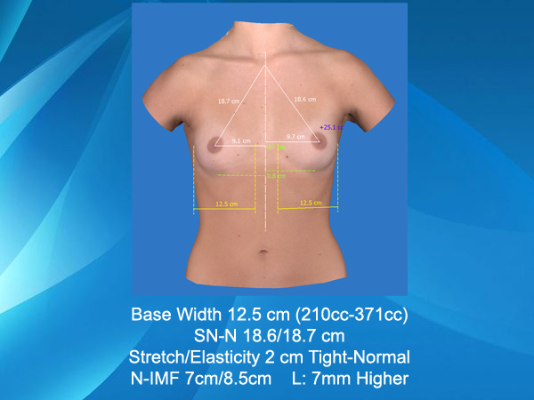 Vectra 3D Imaging comparison