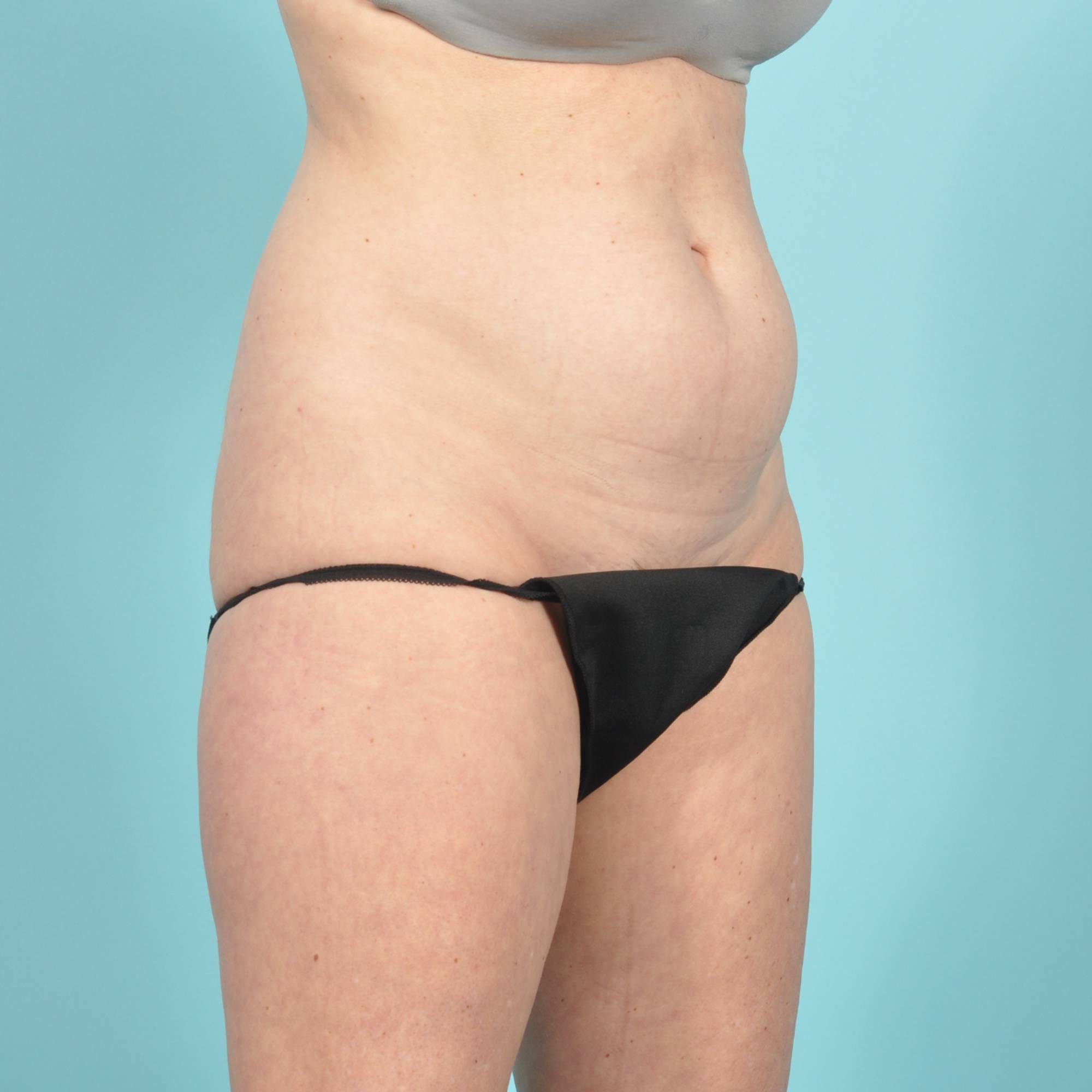  Before & After Image