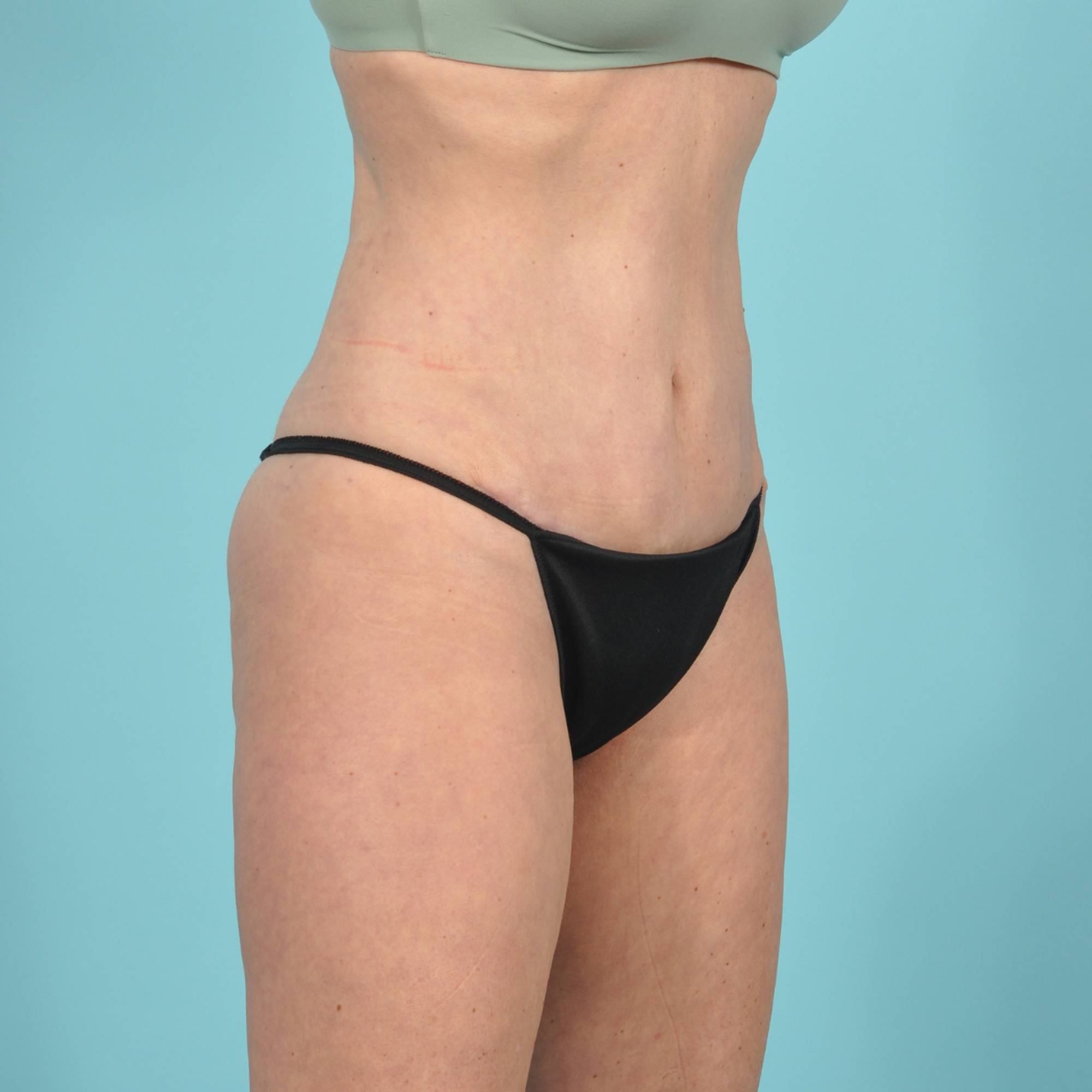  Before & After Image