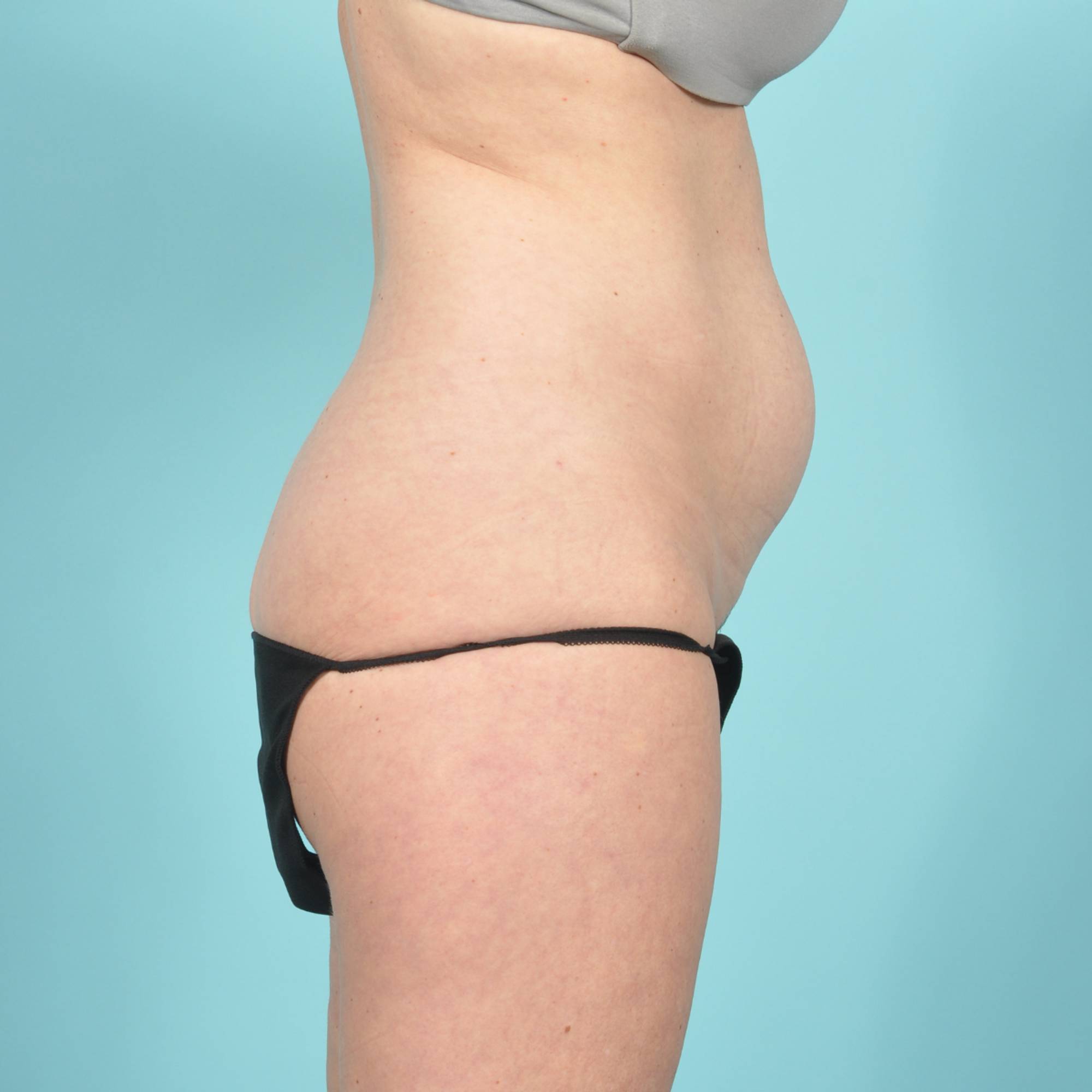  Before & After Image