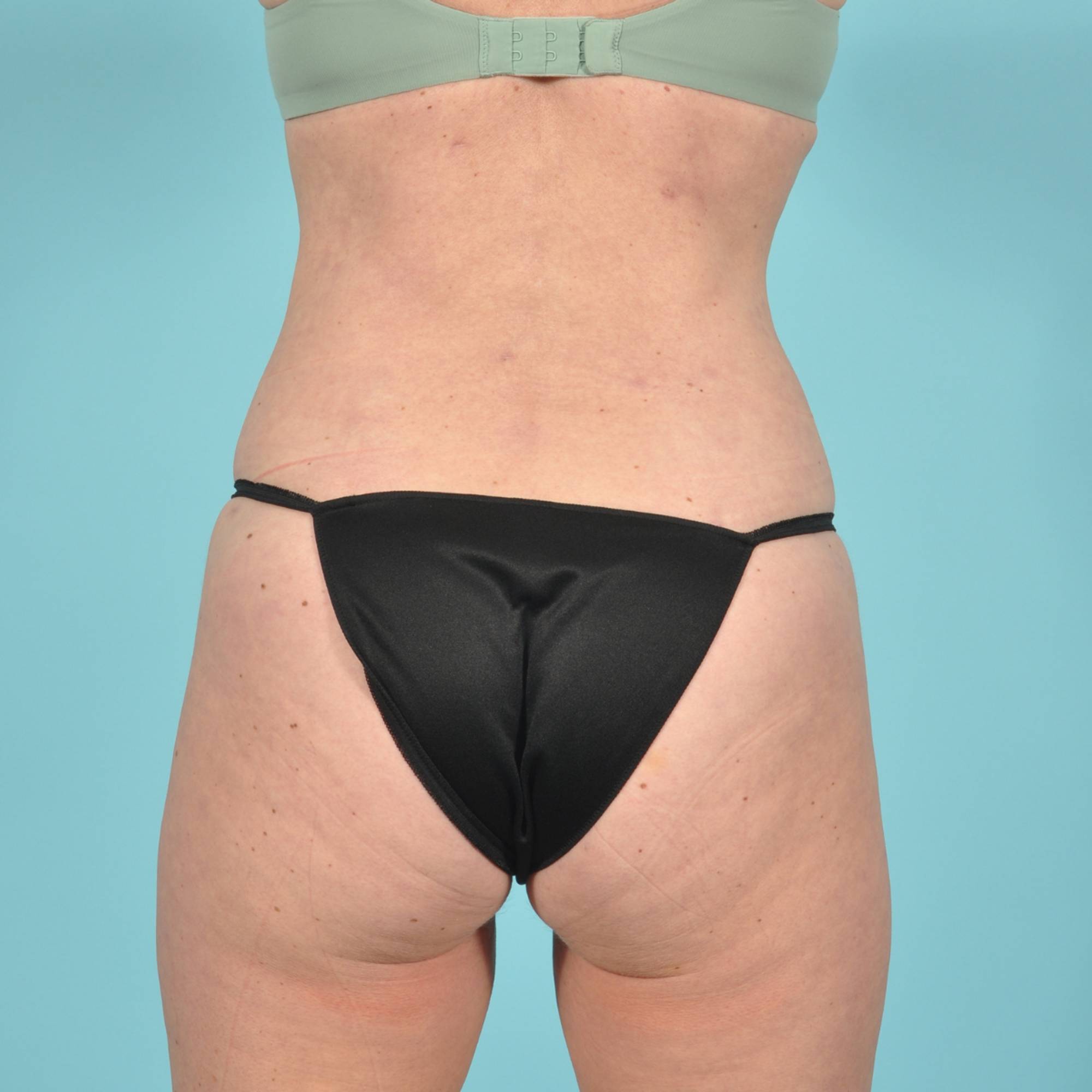  Before & After Image