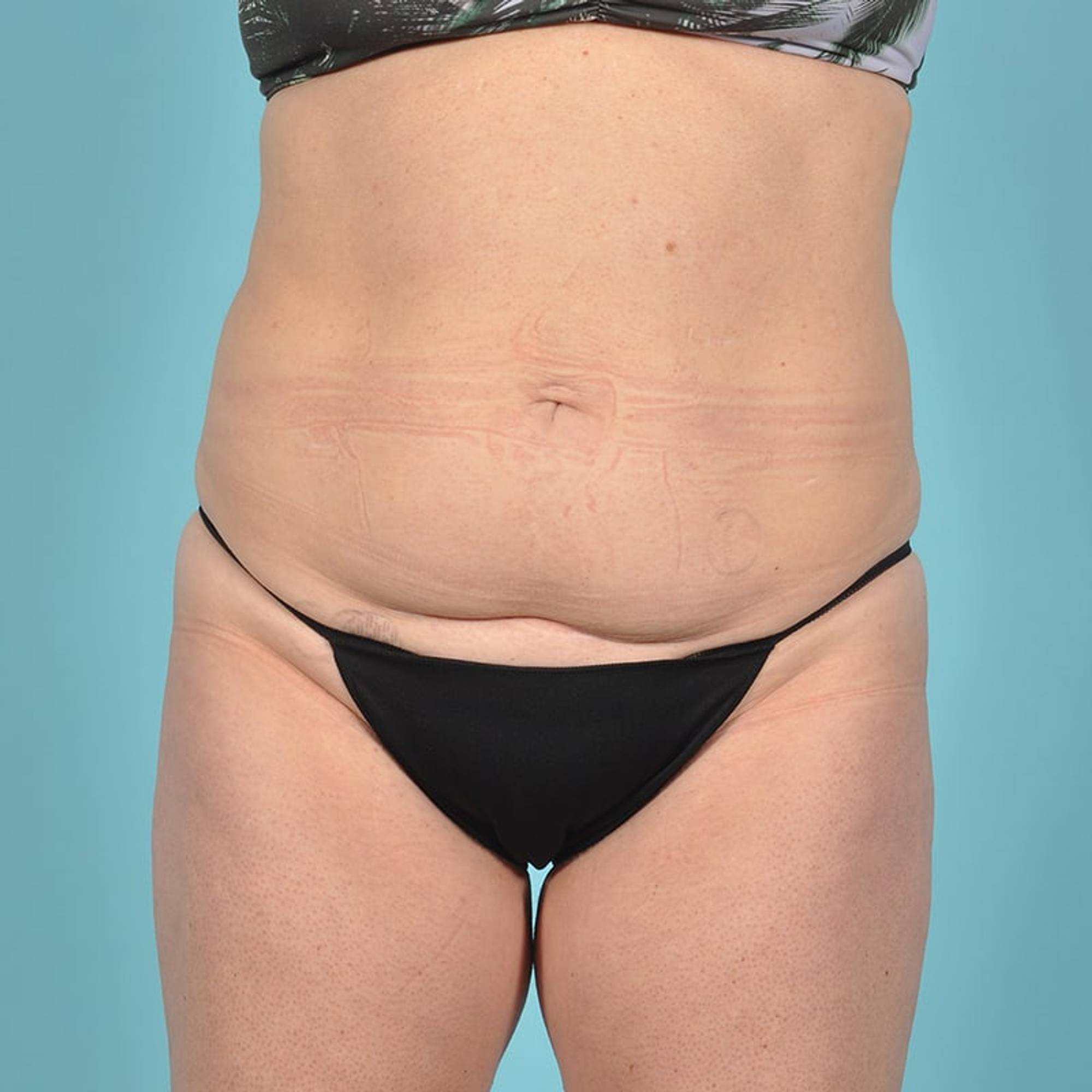  Before & After Image