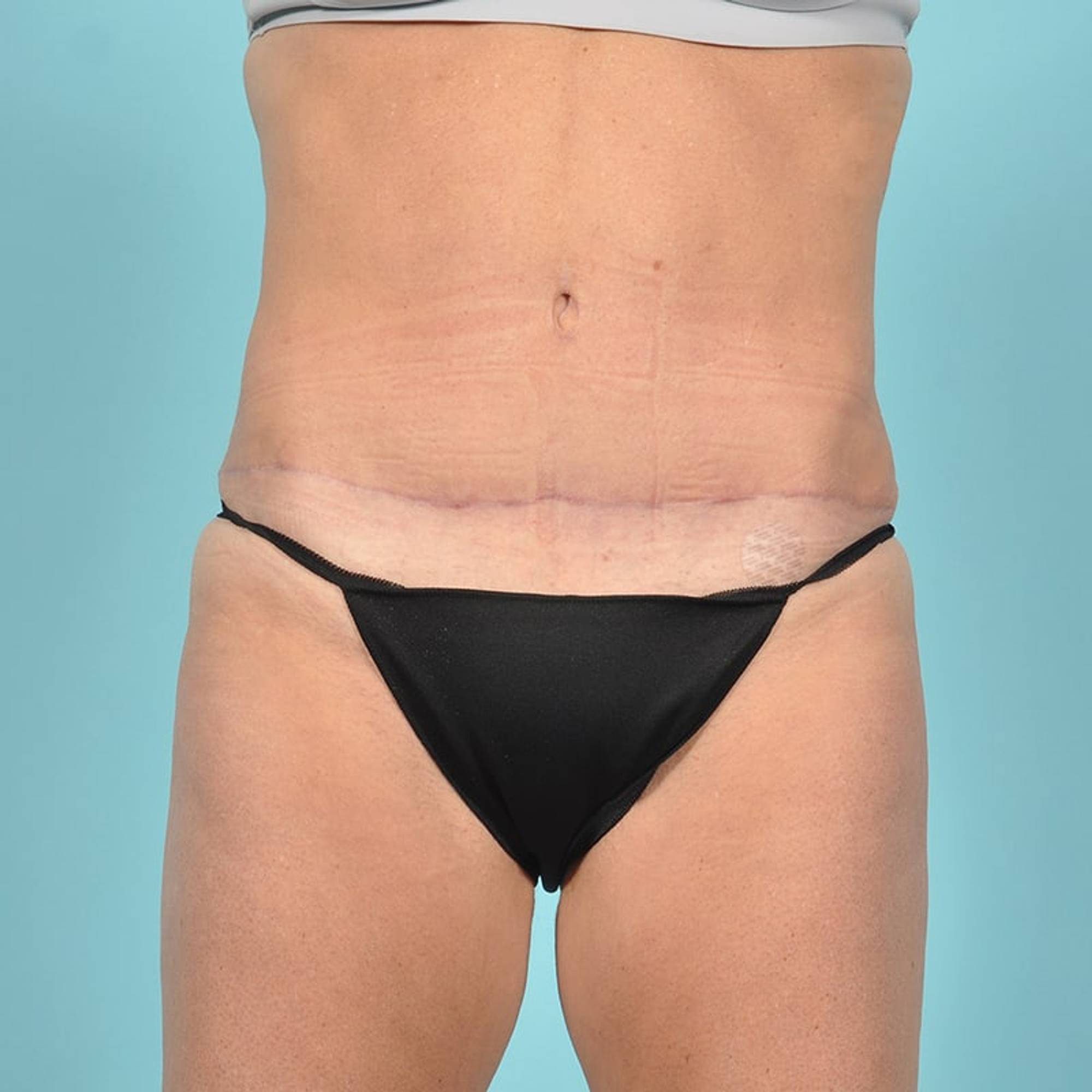  Before & After Image