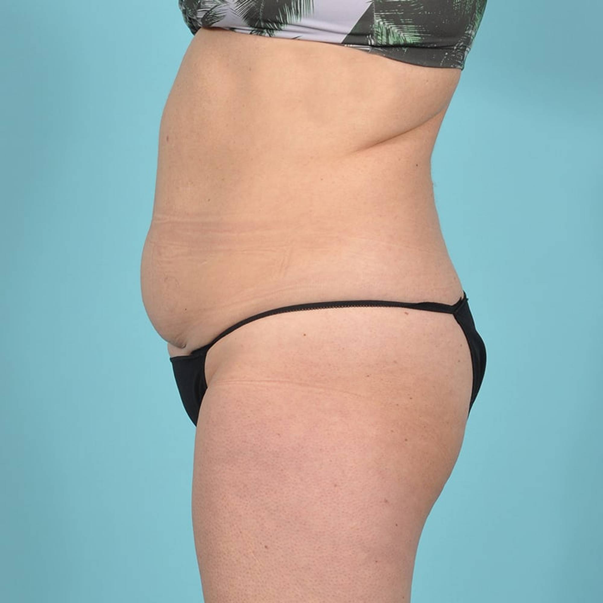  Before & After Image