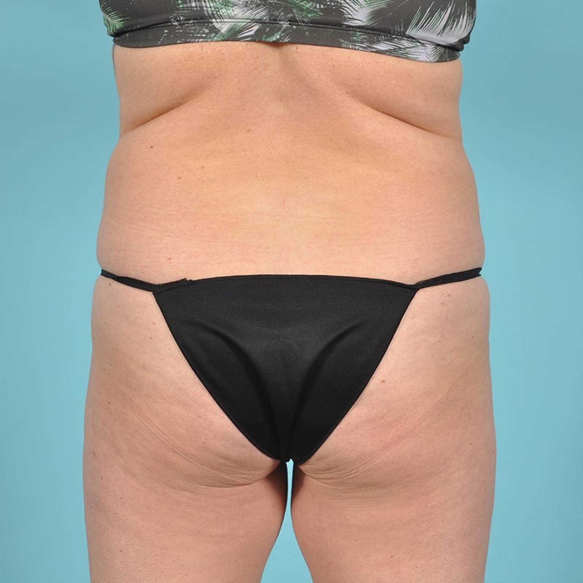  Before & After Image