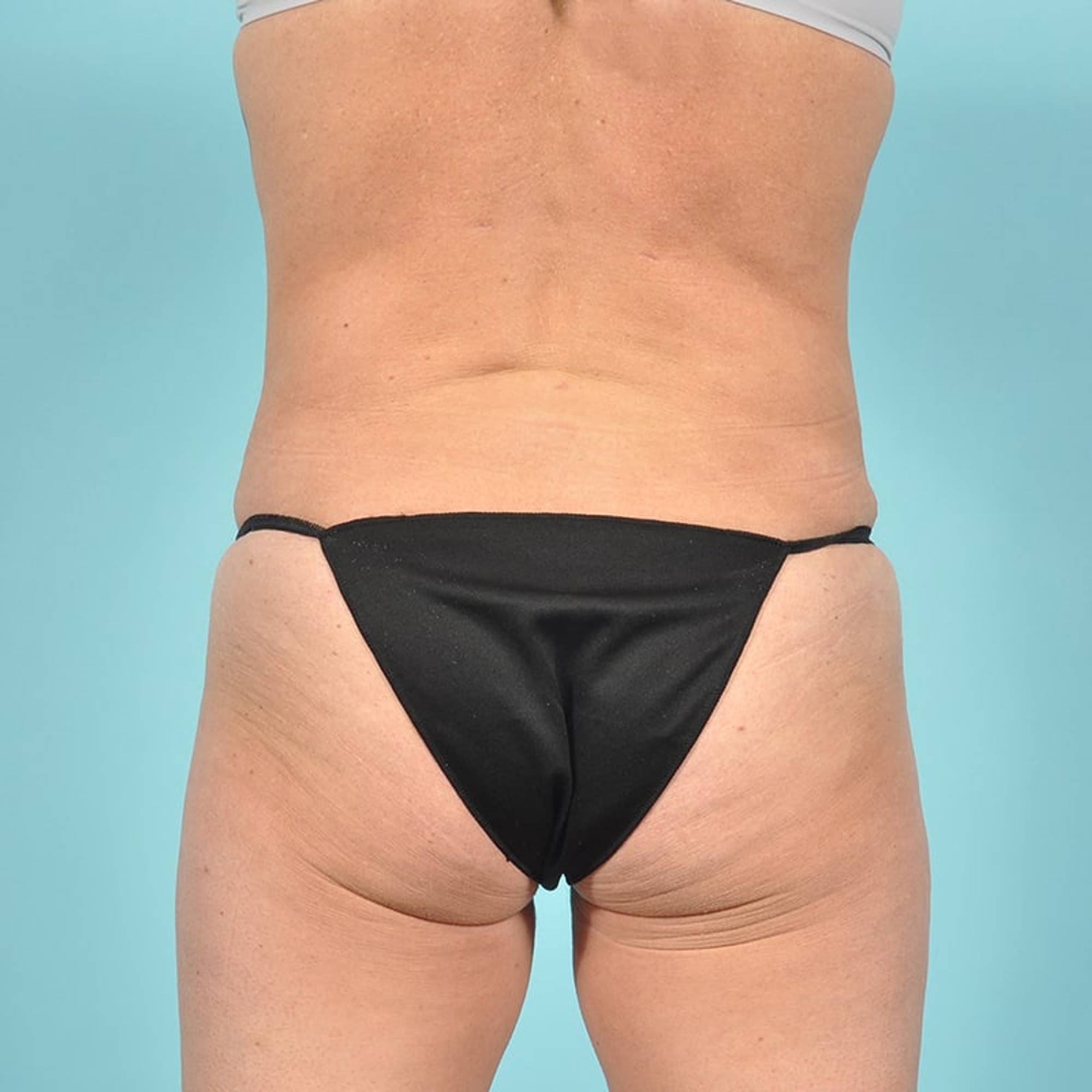  Before & After Image