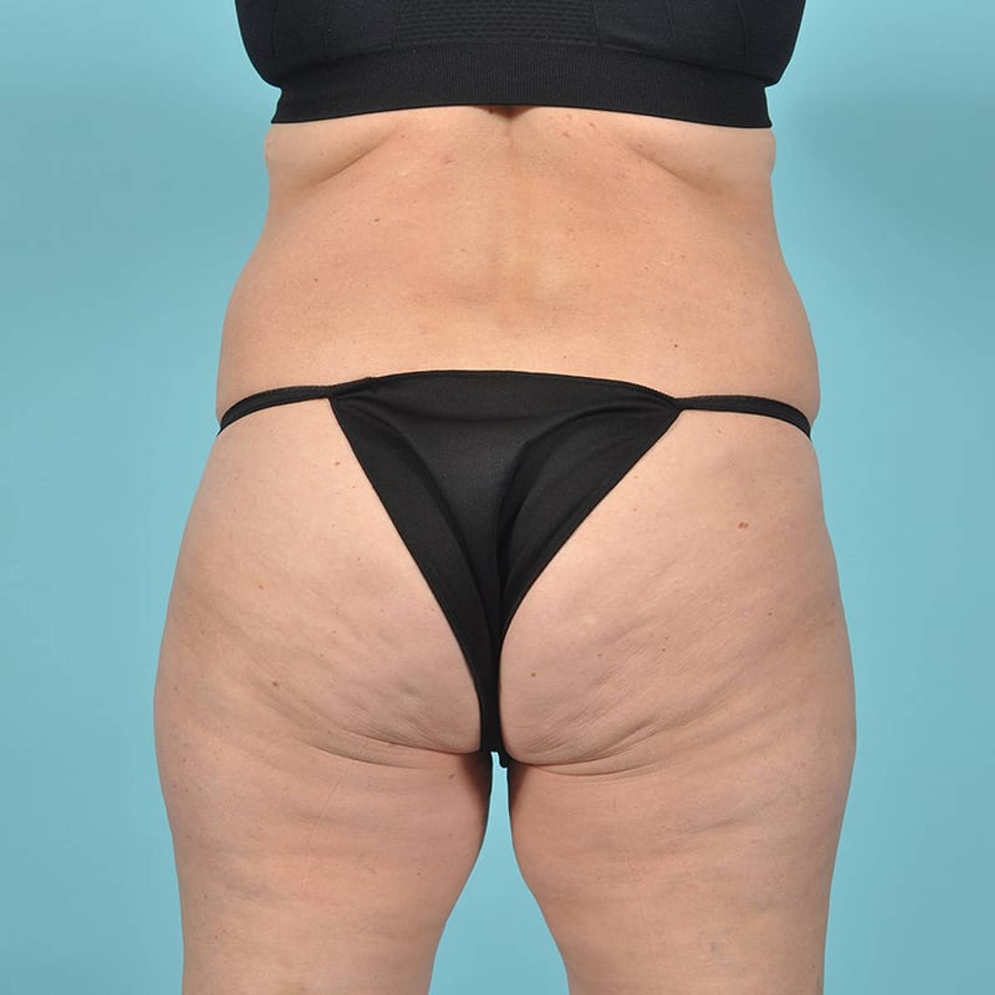 Before & After Image