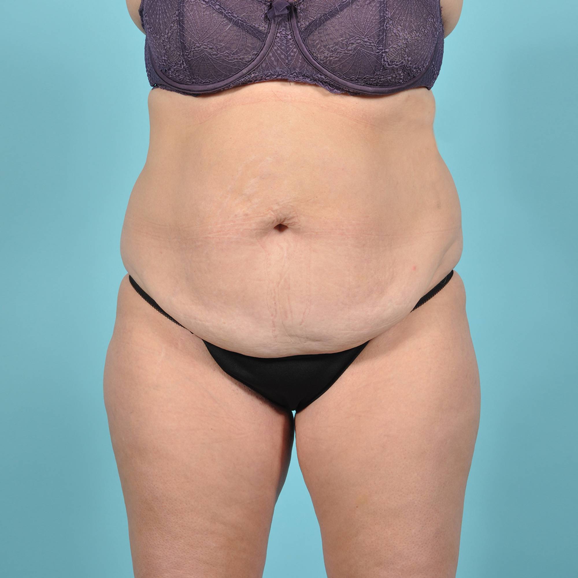  Before & After Image