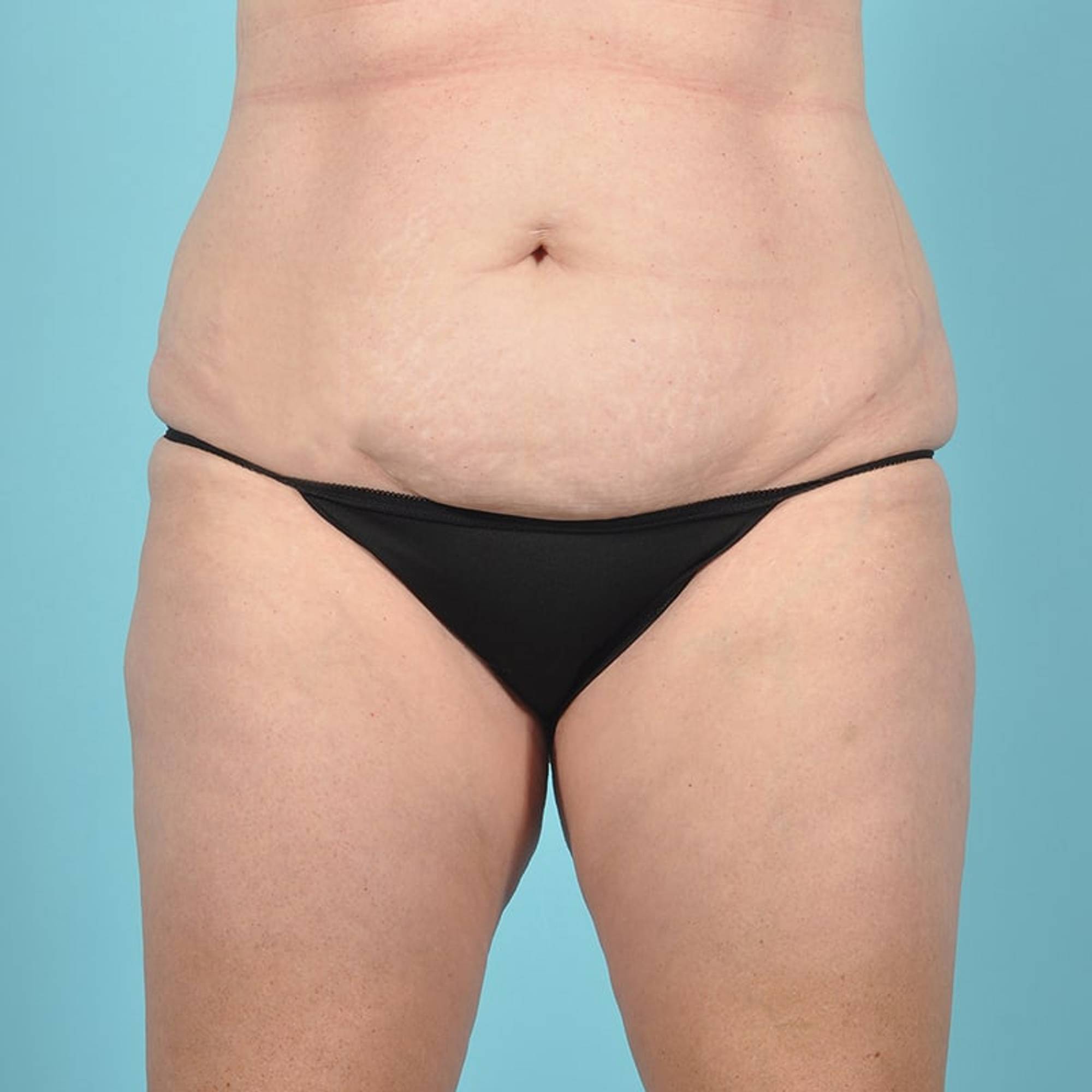  Before & After Image