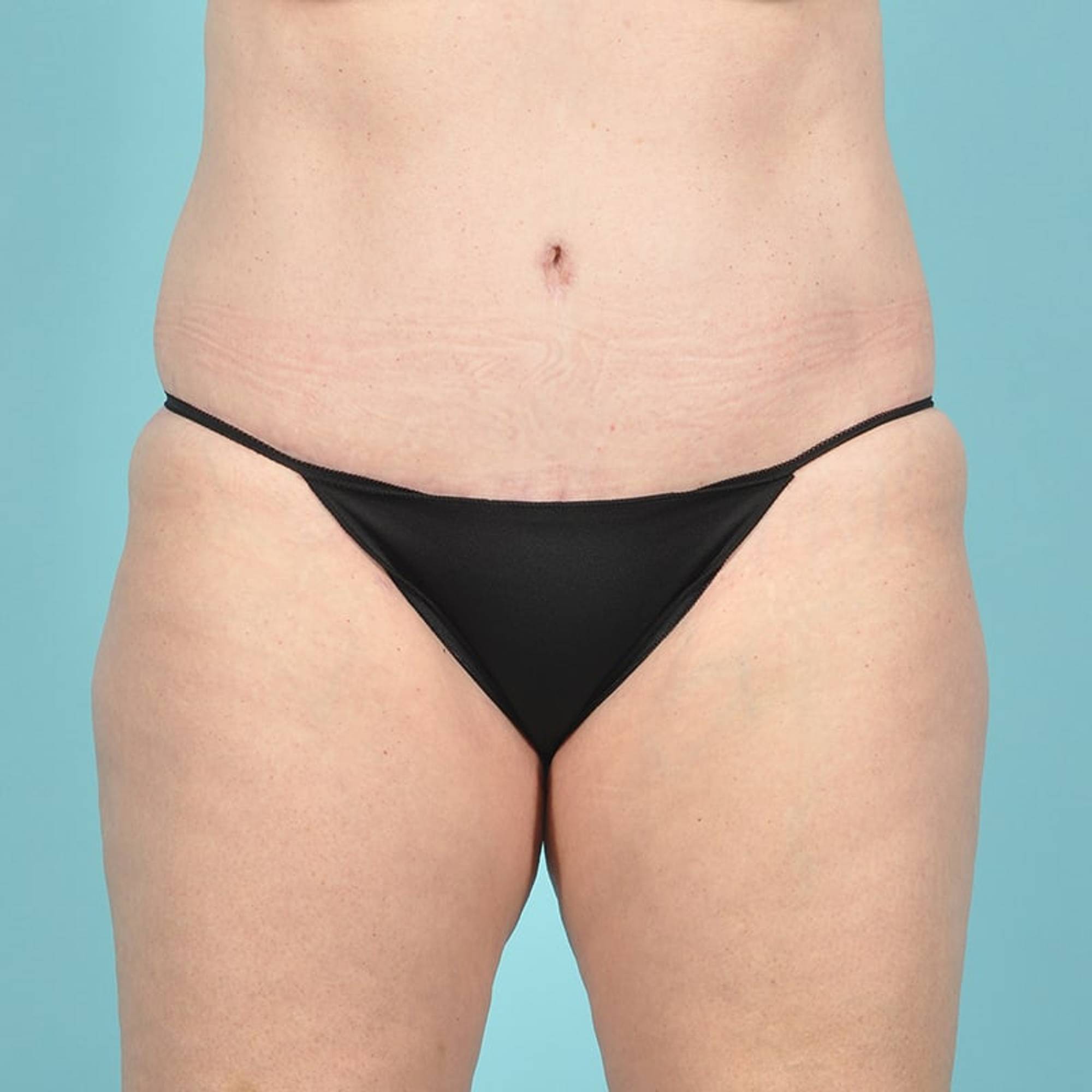  Before & After Image