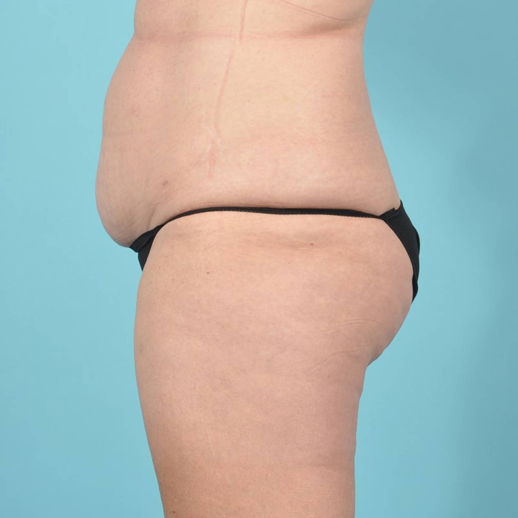 Before & After Image