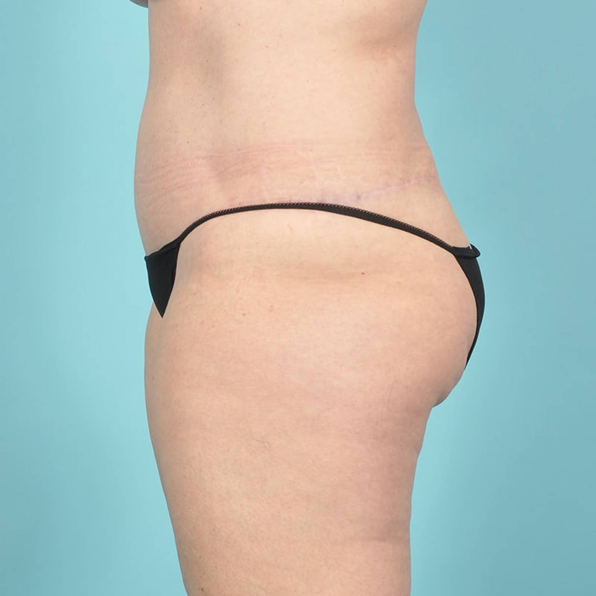  Before & After Image