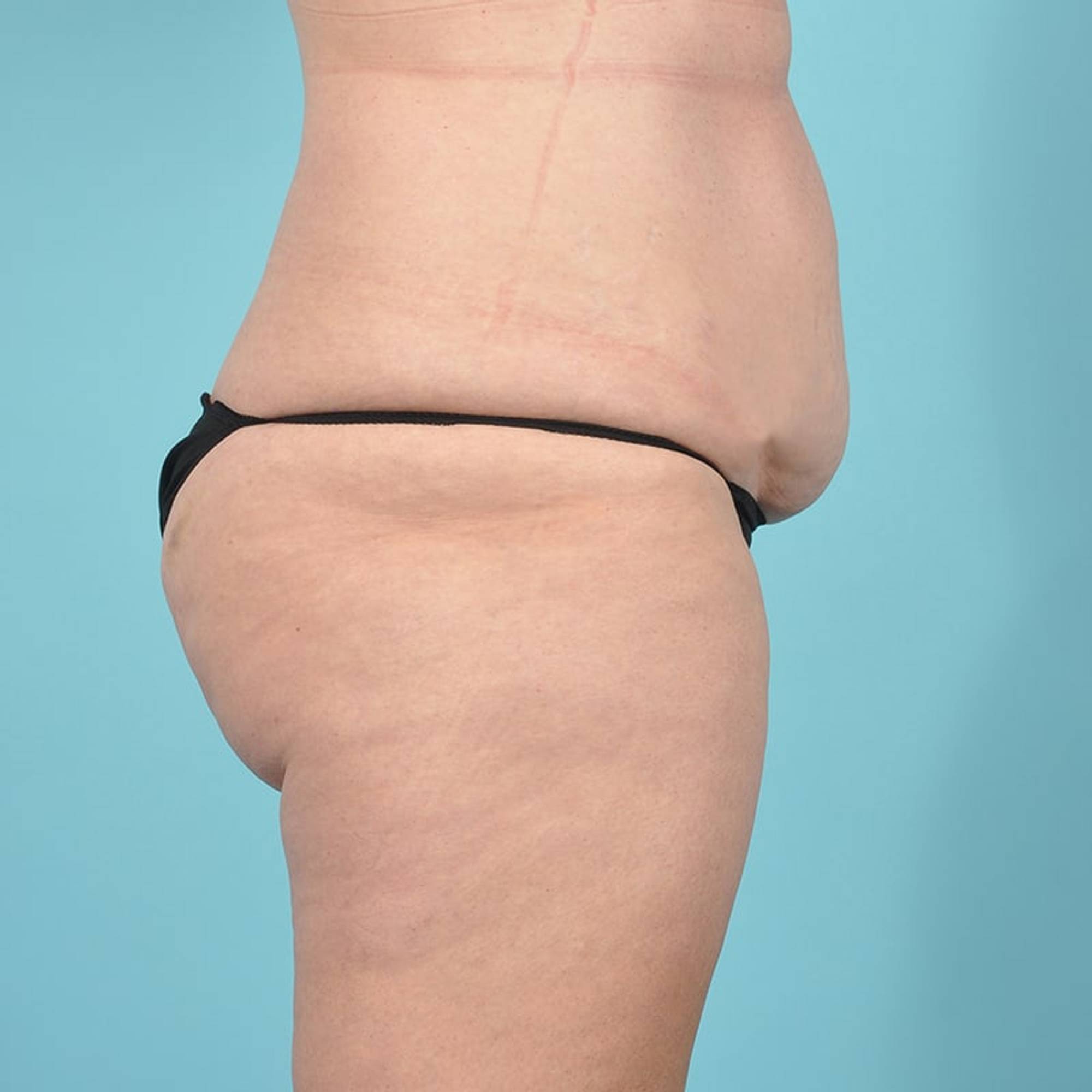  Before & After Image