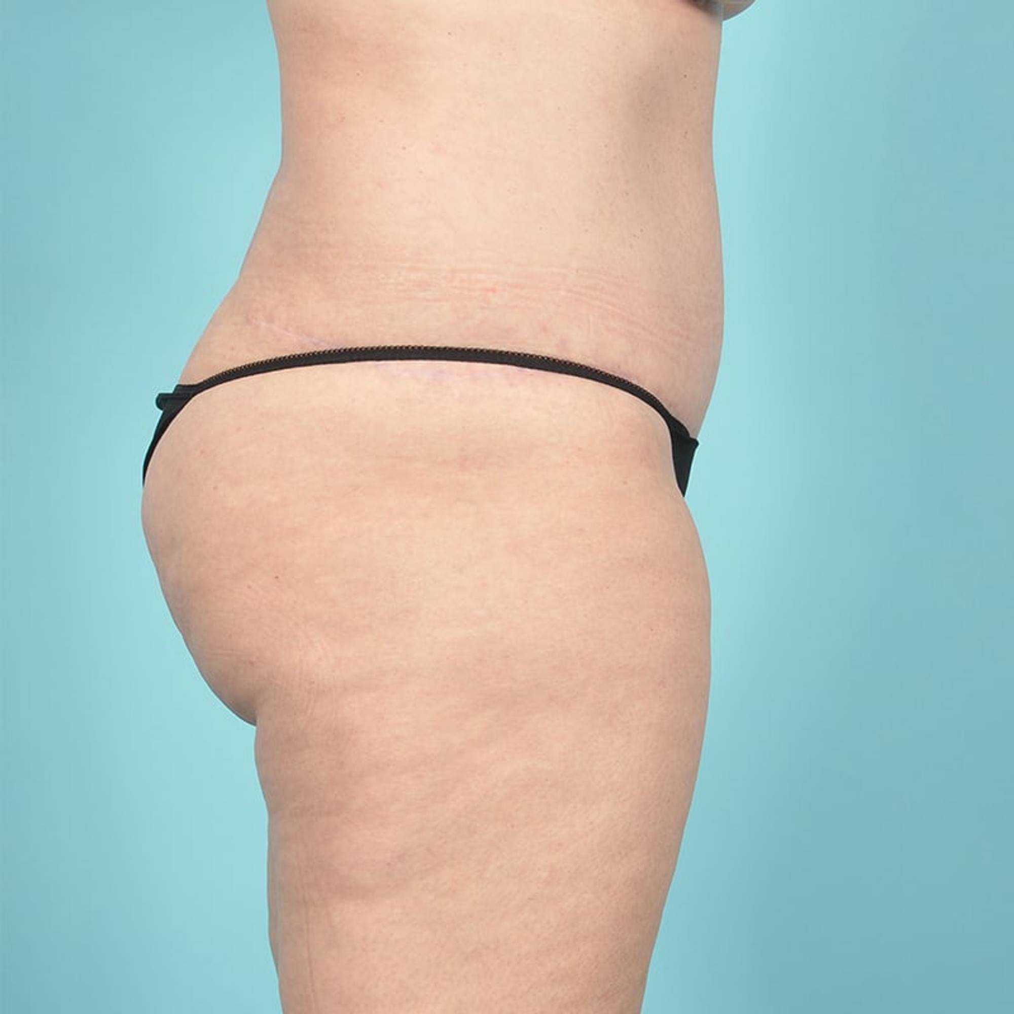  Before & After Image