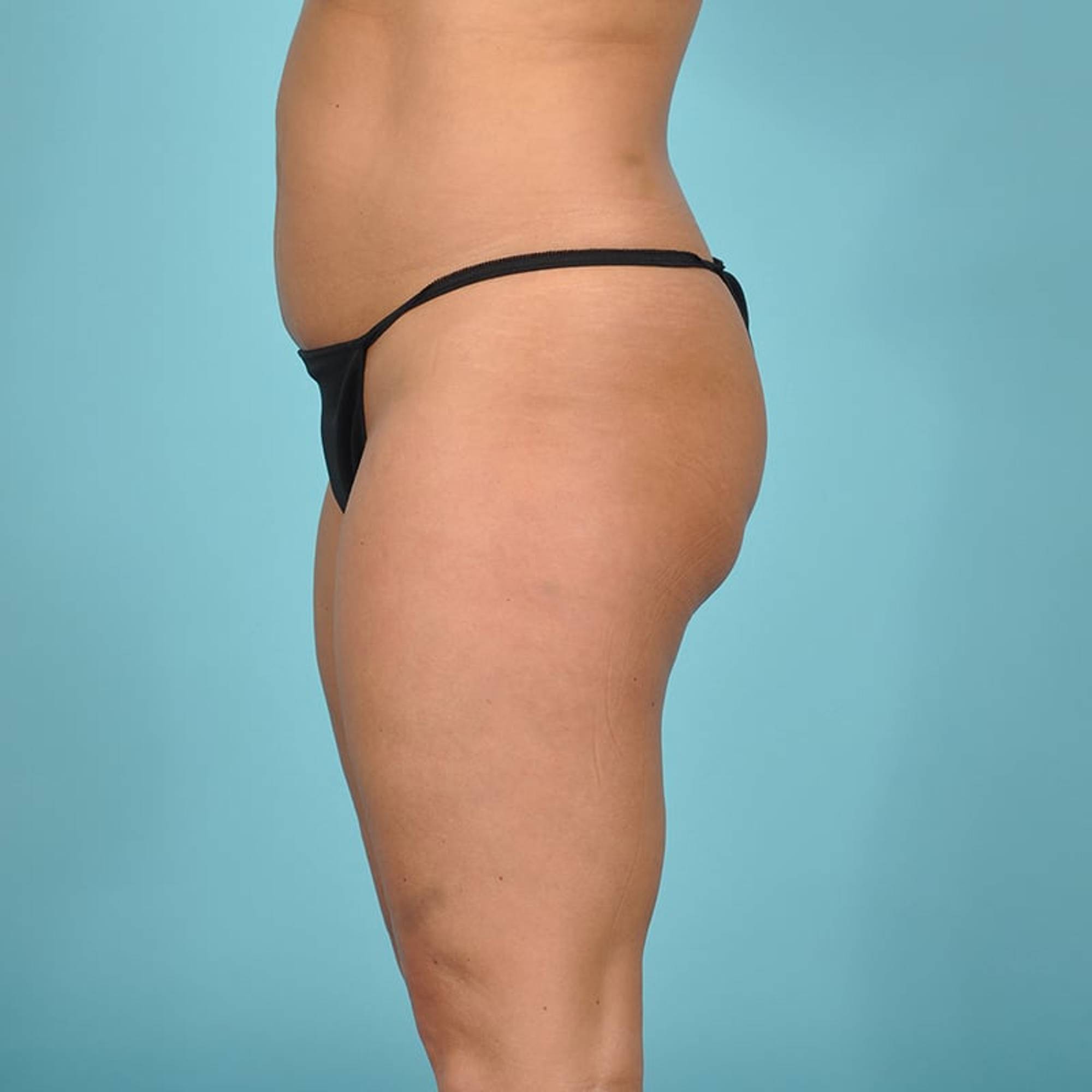 Before & After Image