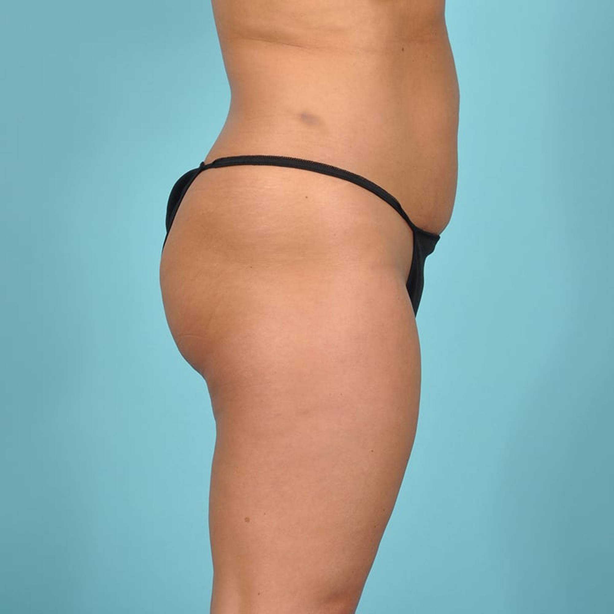  Before & After Image