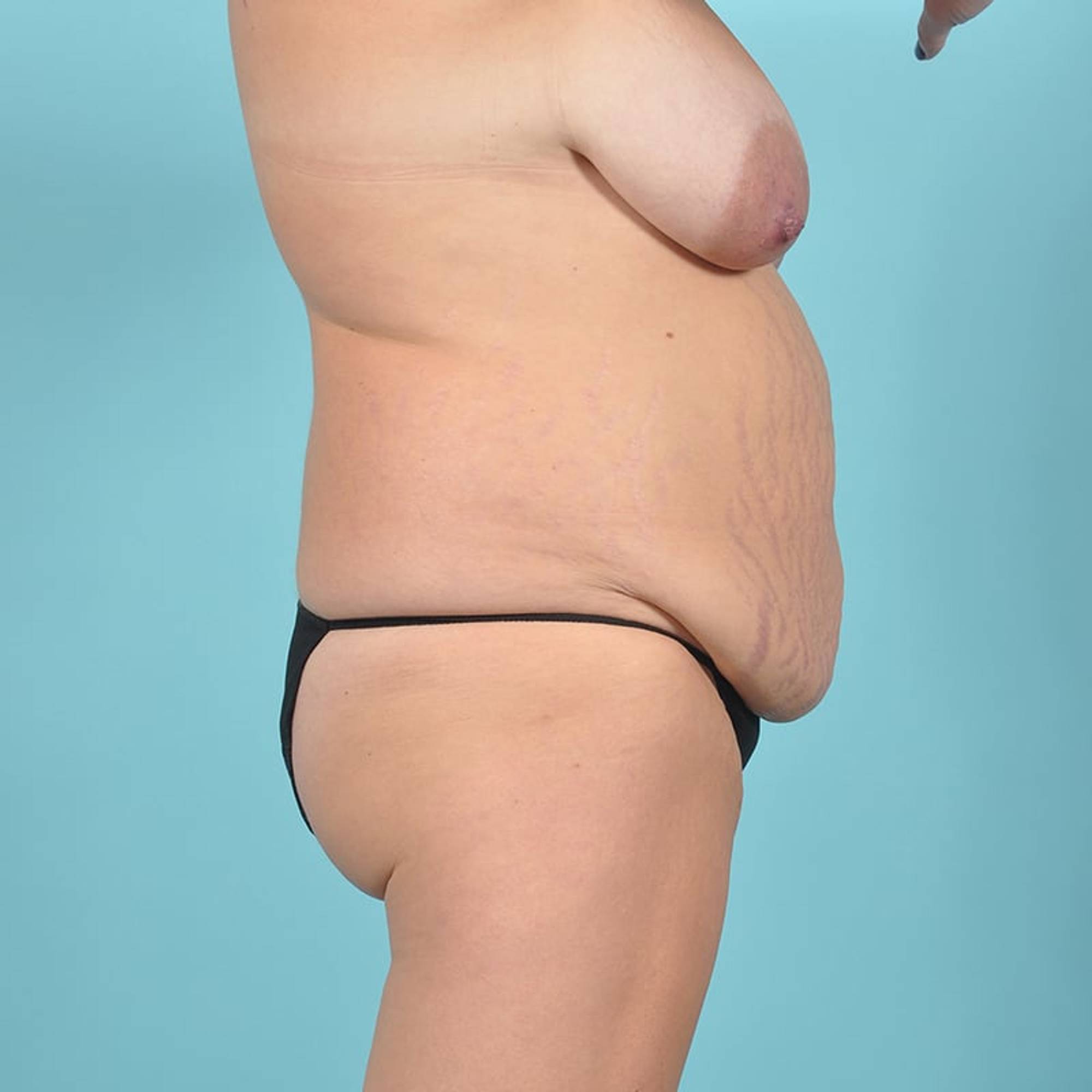  Before & After Image