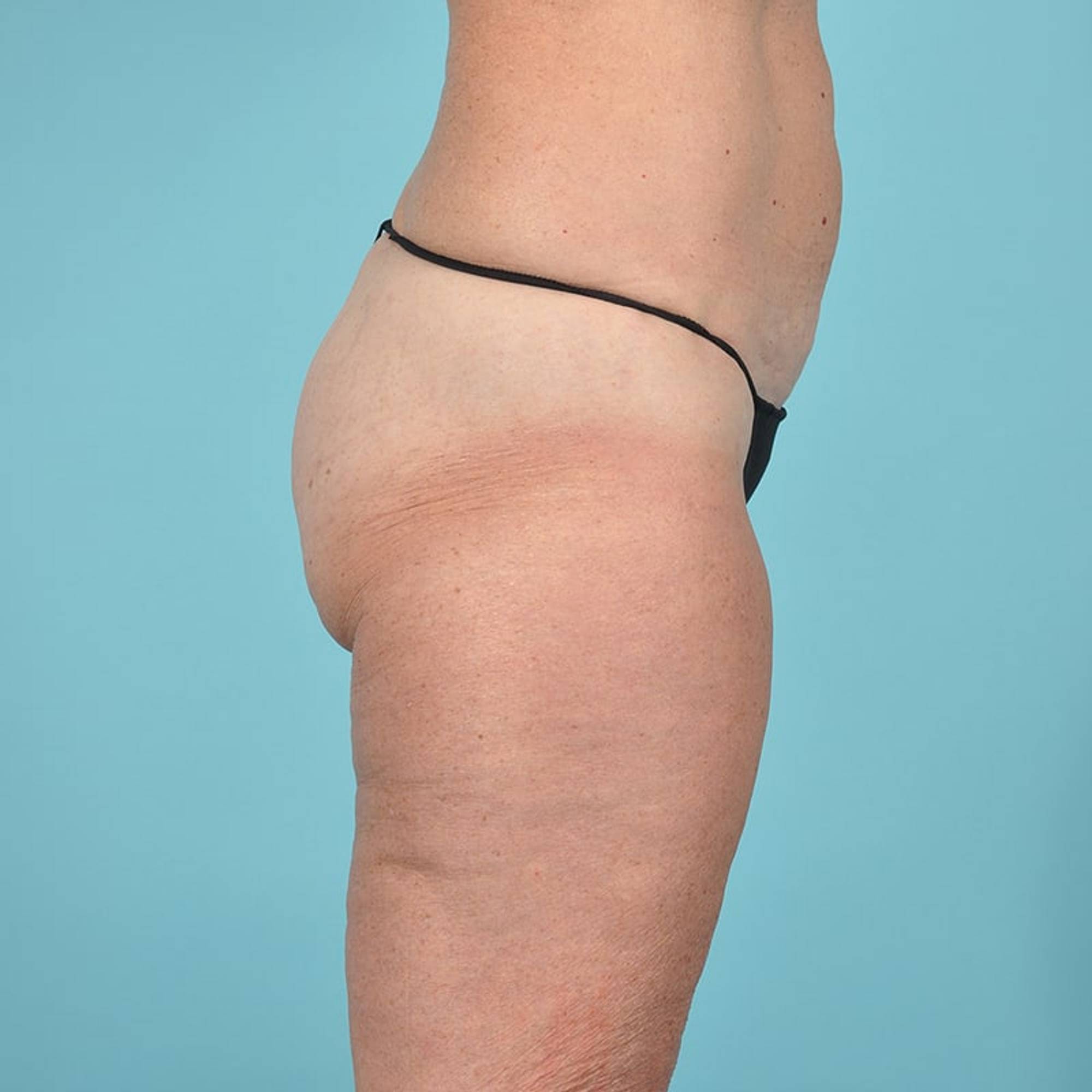  Before & After Image