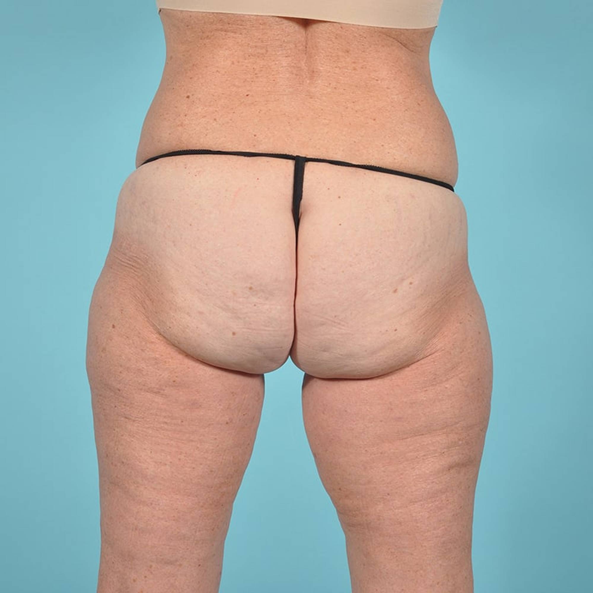  Before & After Image