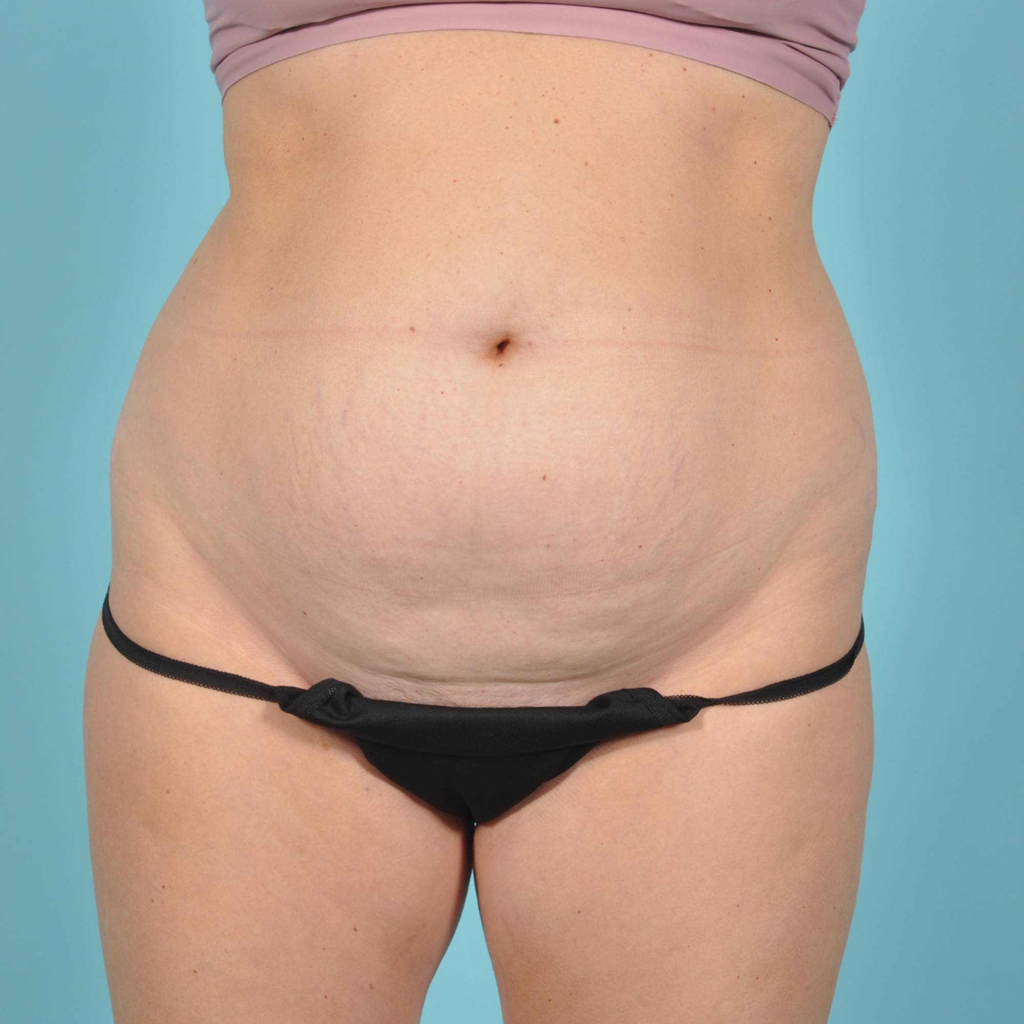  Before & After Image
