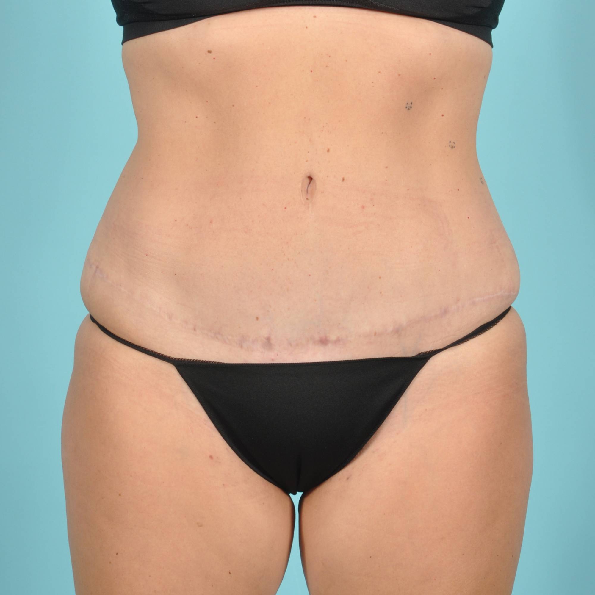  Before & After Image