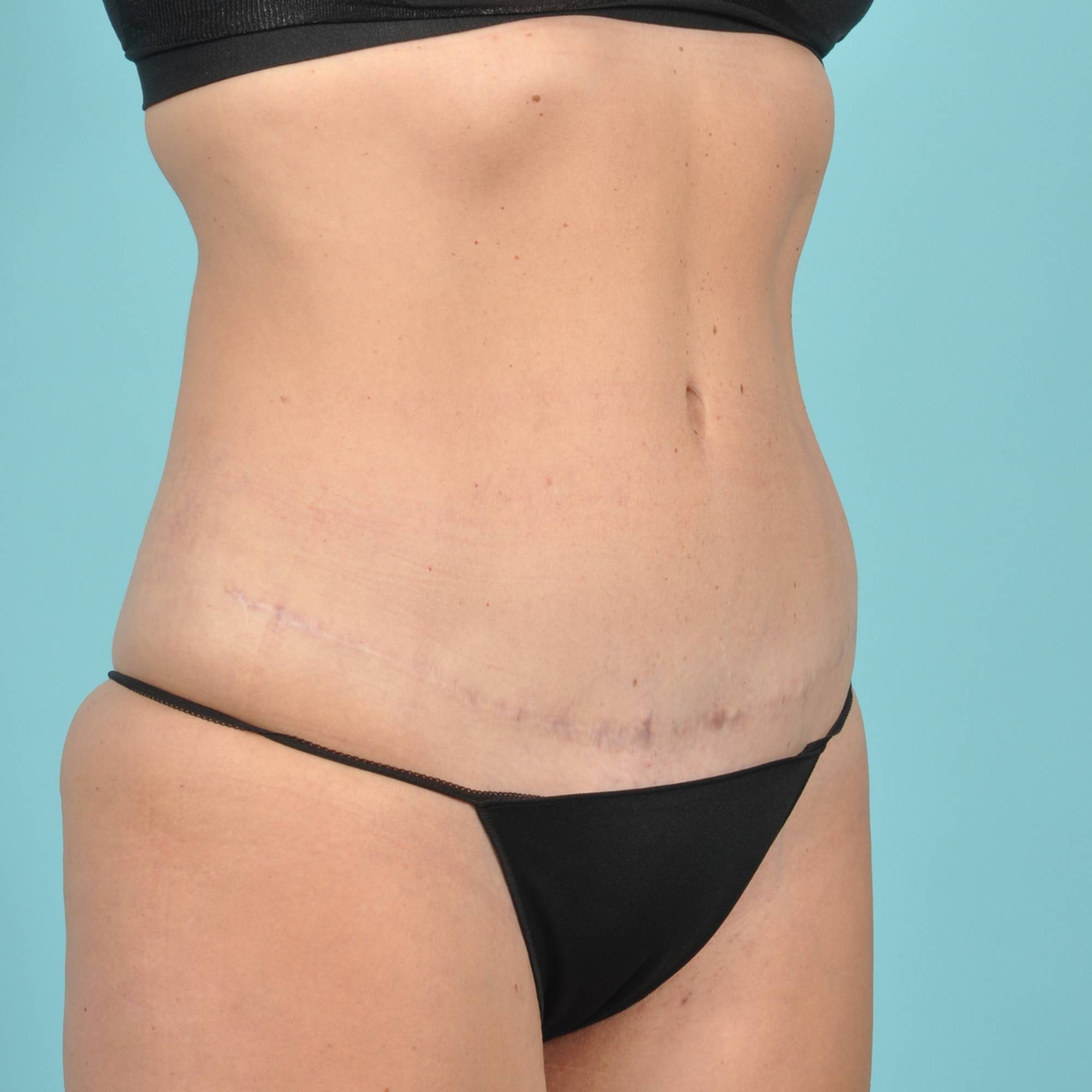  Before & After Image