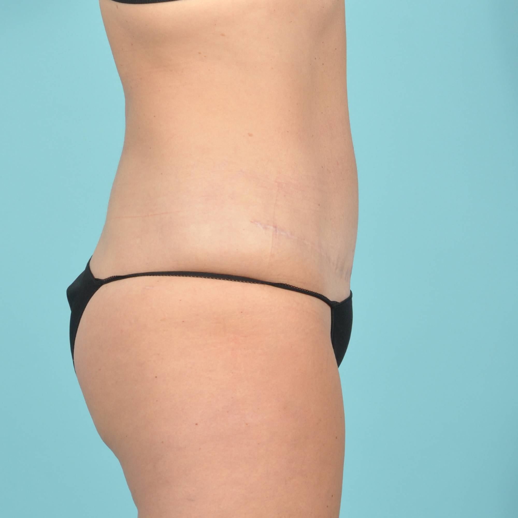  Before & After Image