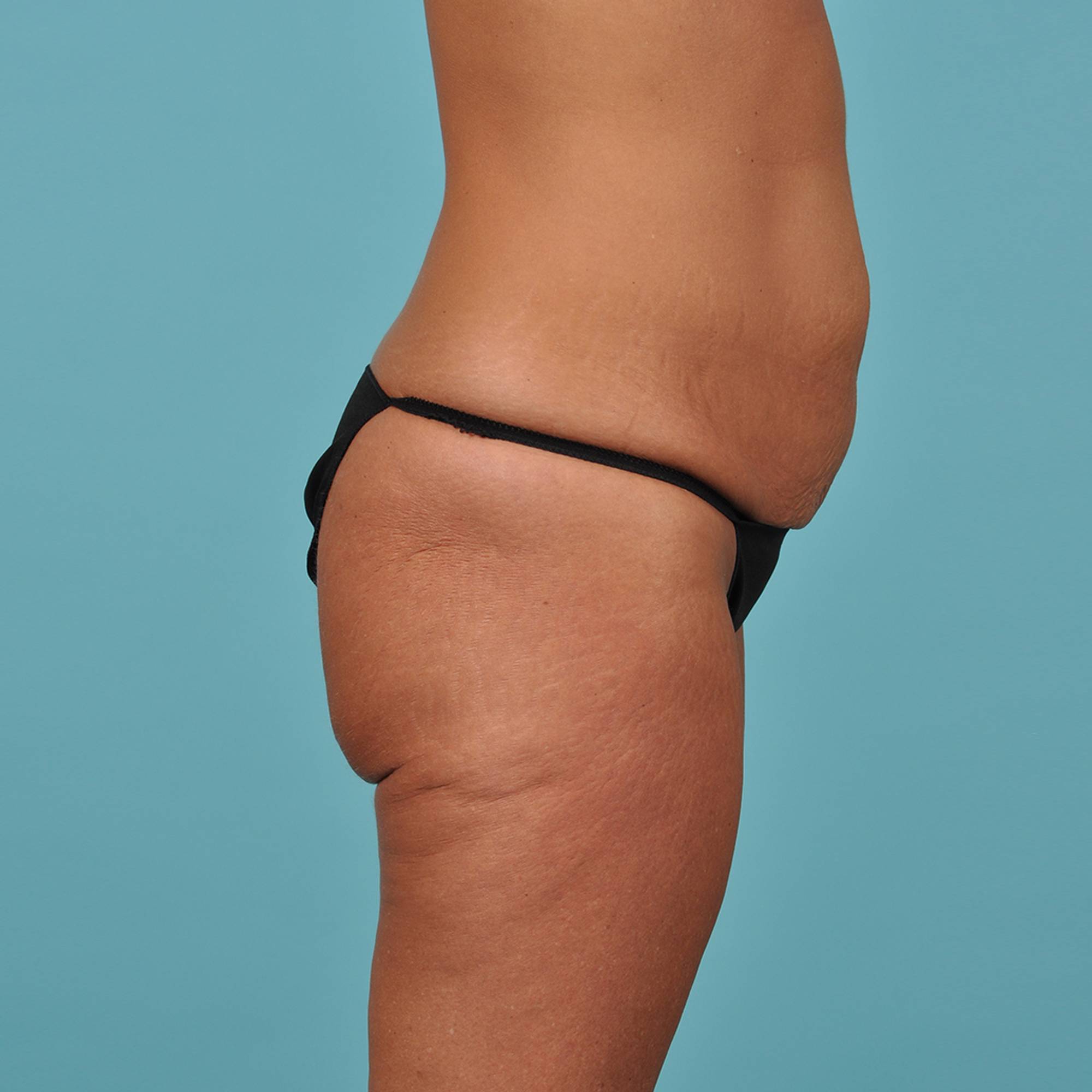  Before & After Image