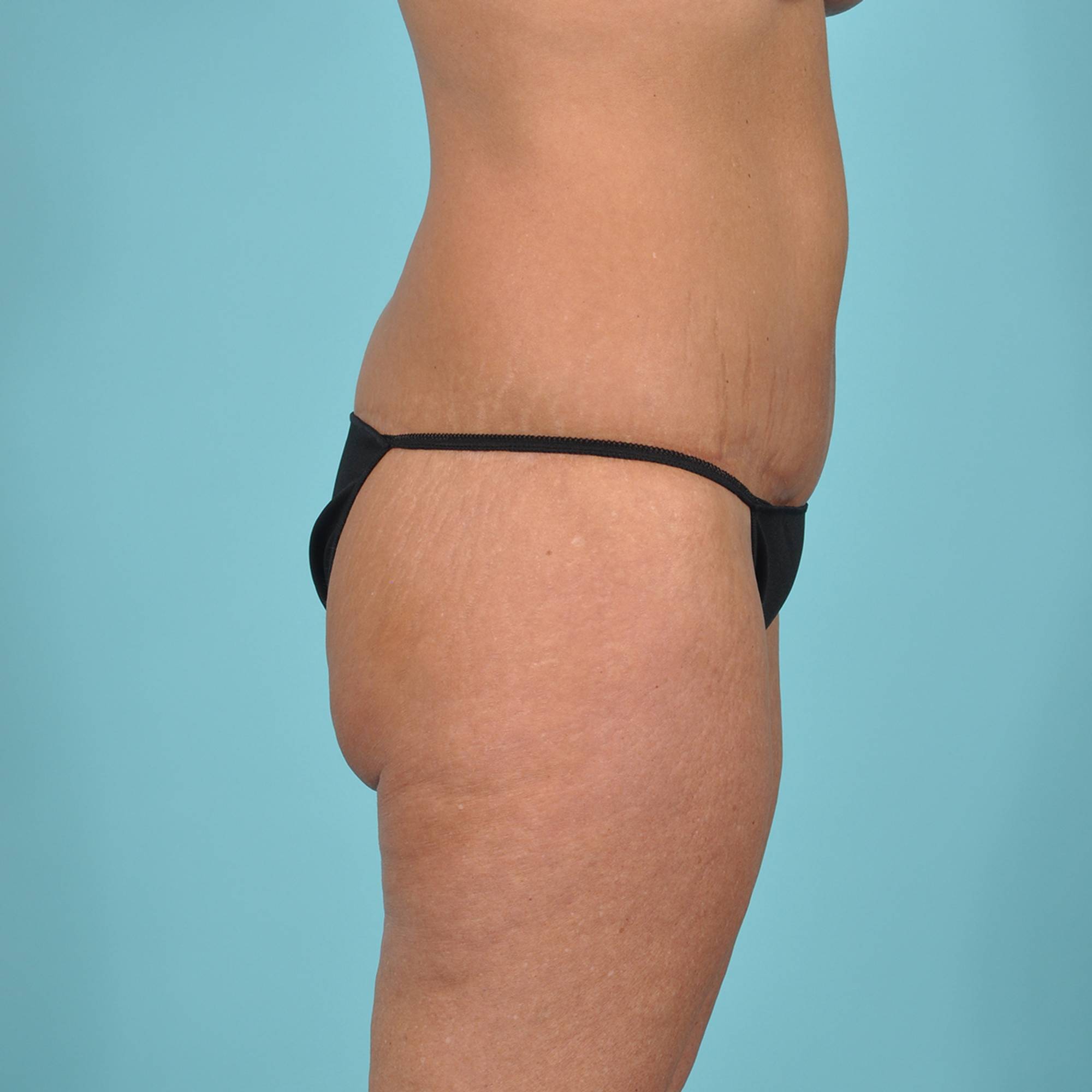  Before & After Image