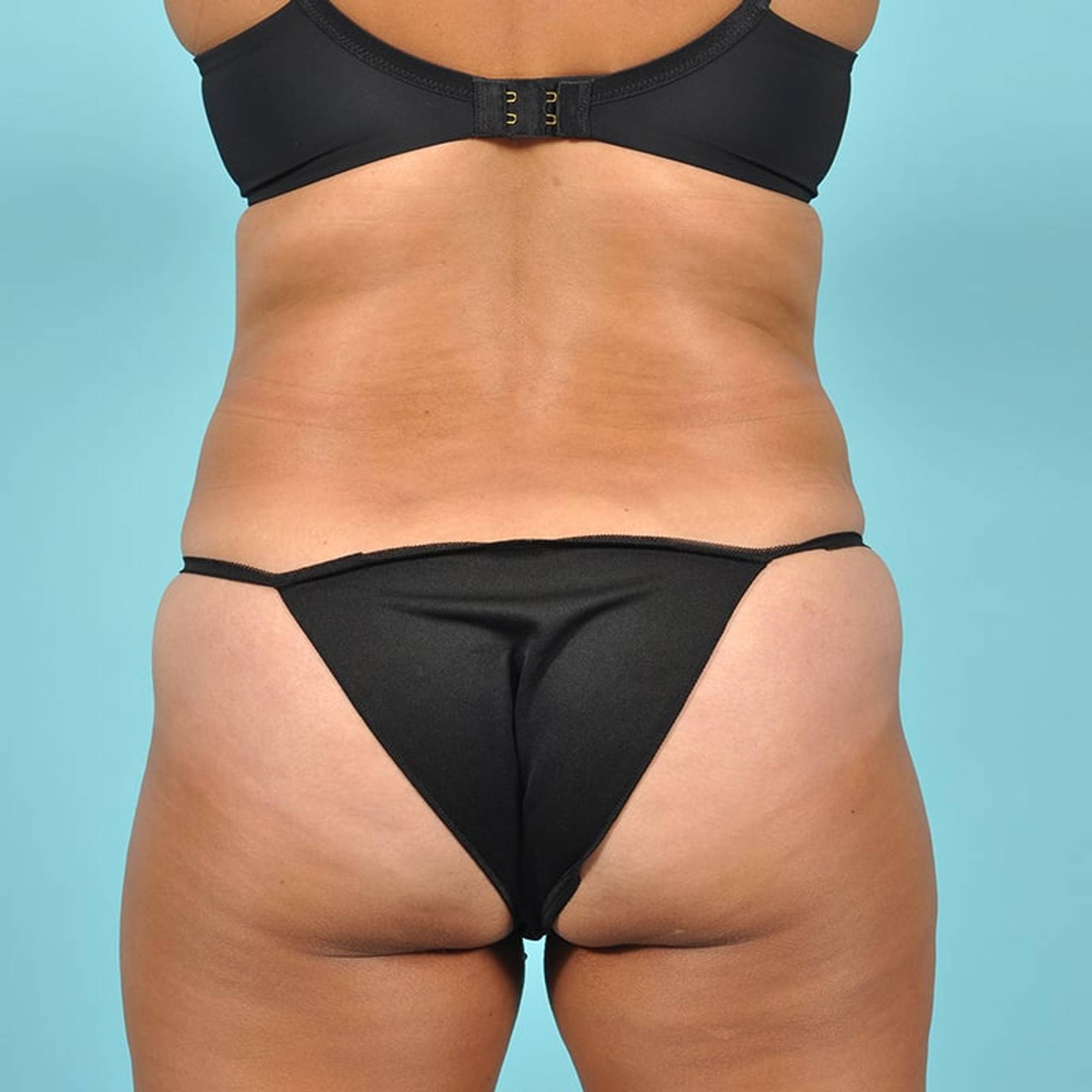  Before & After Image