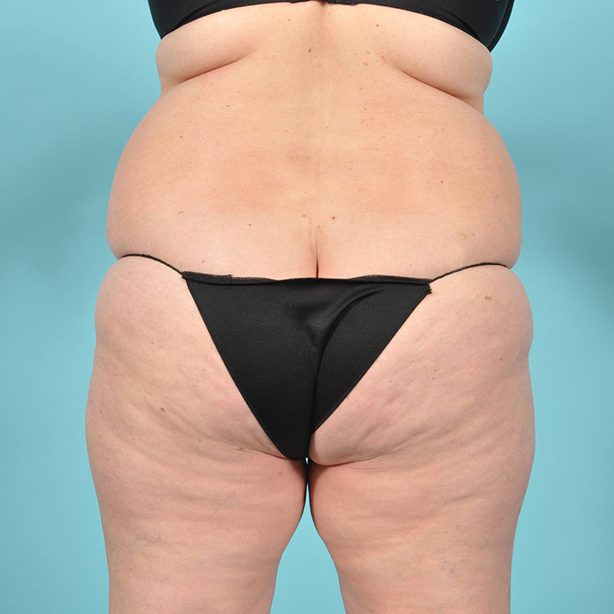 Before & After Image